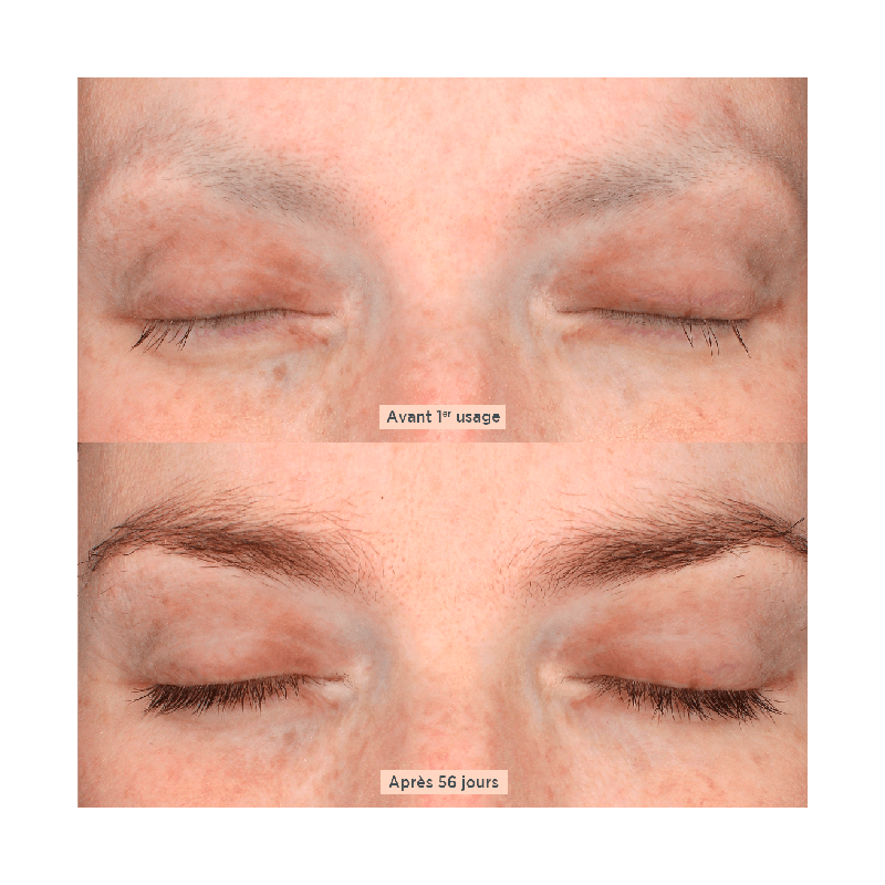 Before and after Lash and Brow Densifying Serum - MÊME Cosmetics