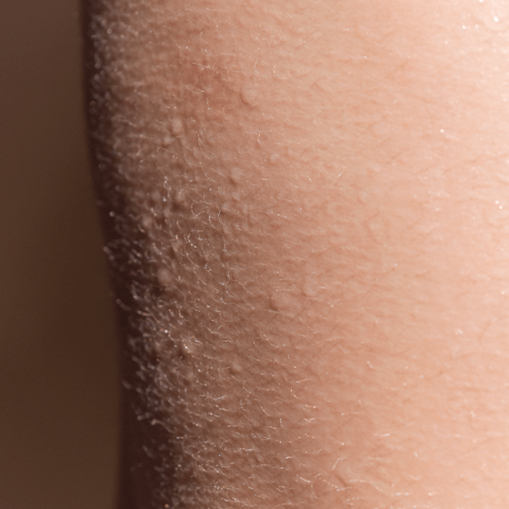 Eau de soin apporte une sensation de fraicheur à votre peau sensible - MÊME Cosmetics