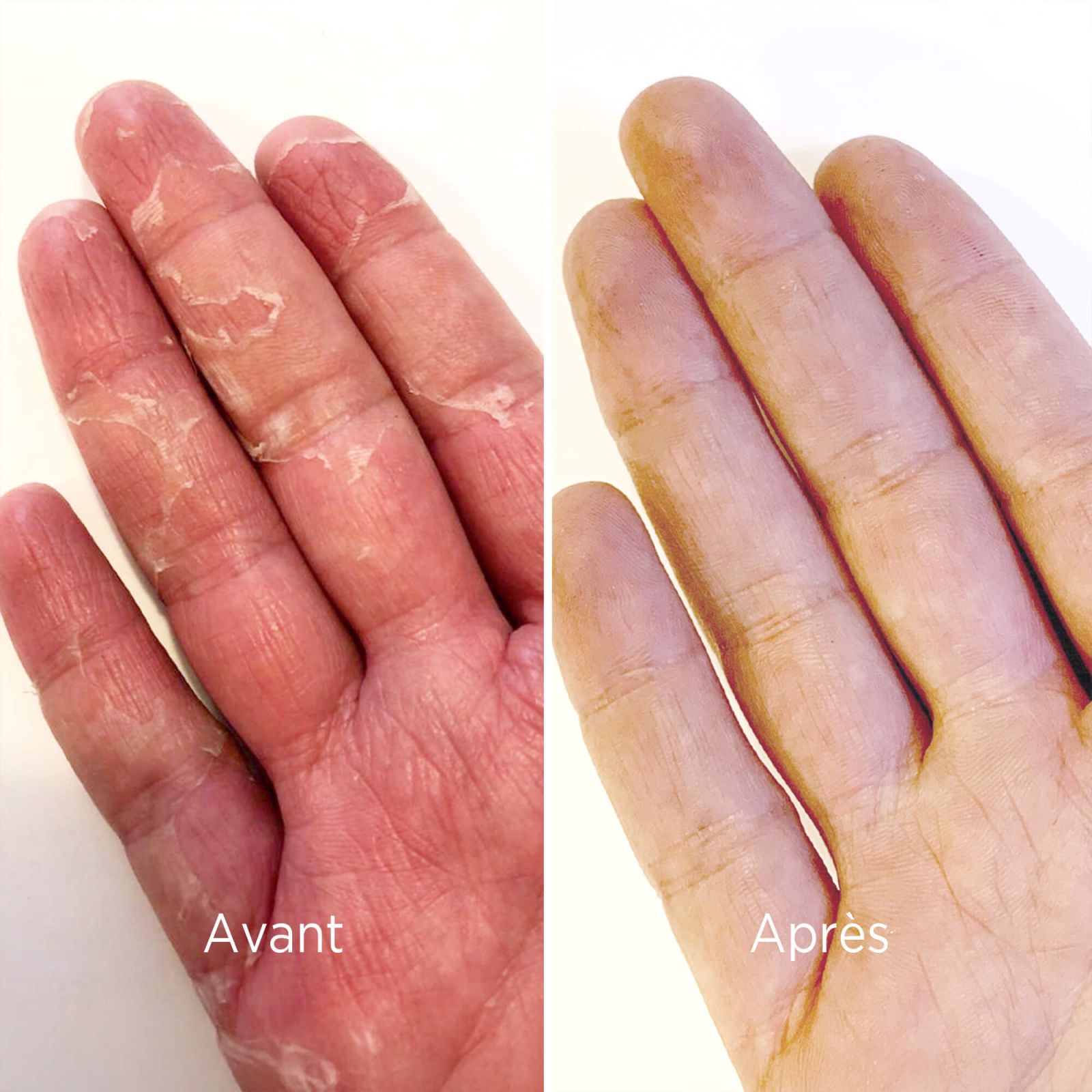 Moisturising gloves