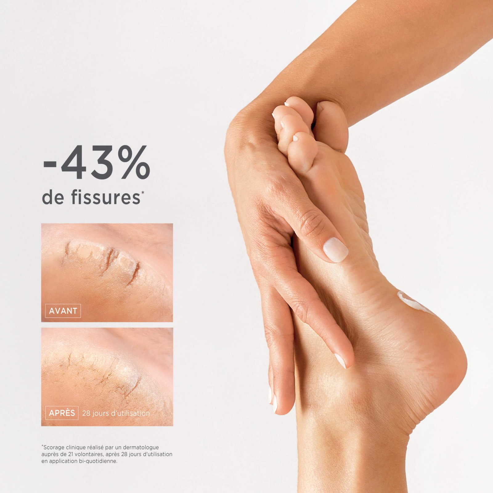 caring for cracked feet - MÊME