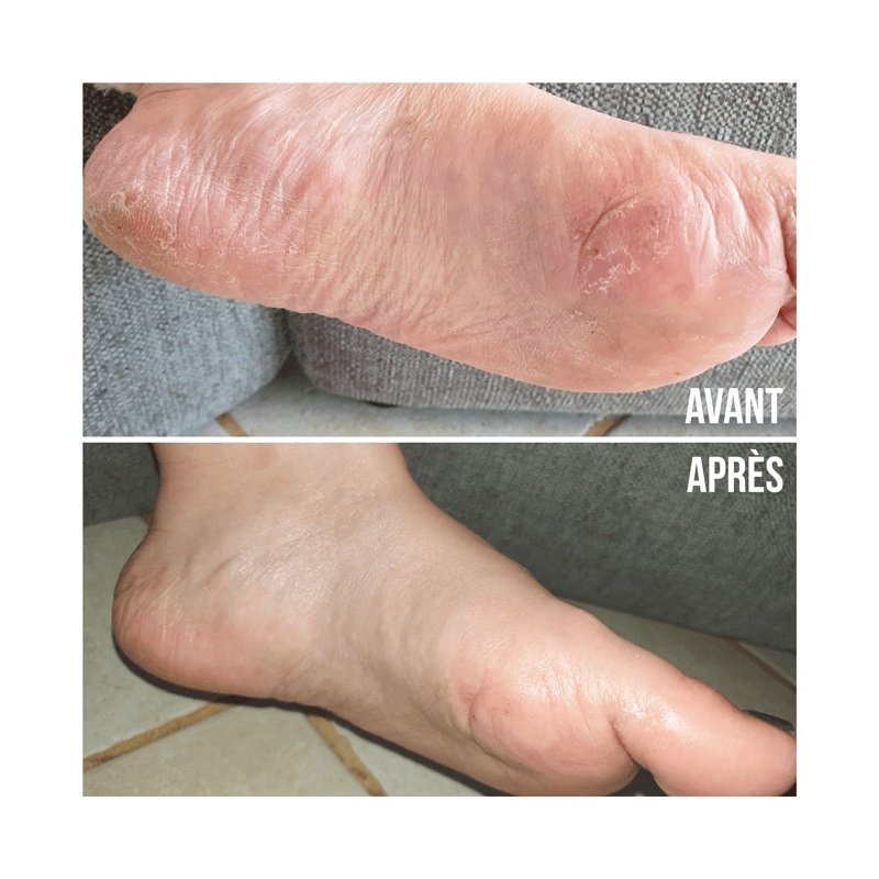 Les Chaussons de Soin - MÊME Cosmetics