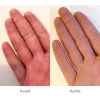 Syndrome mains pieds avant/ après - MÊME Cosmetics