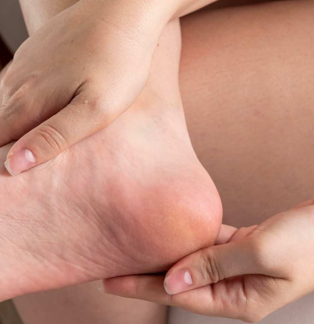 Soin mains et pieds abimées