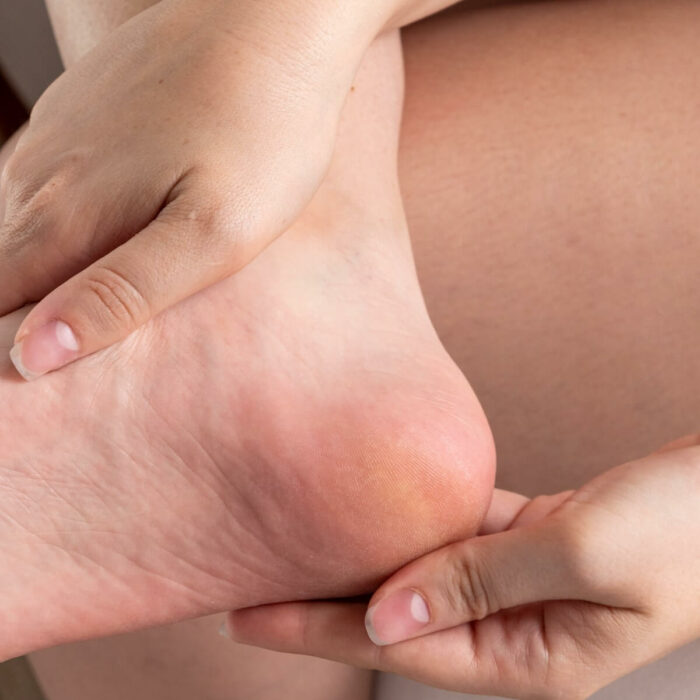 4 étapes pour des jolis pieds, même pendant mon cancer !