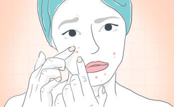 Masque et petits boutons : comment se débarrasser des imperfections et irritations ?