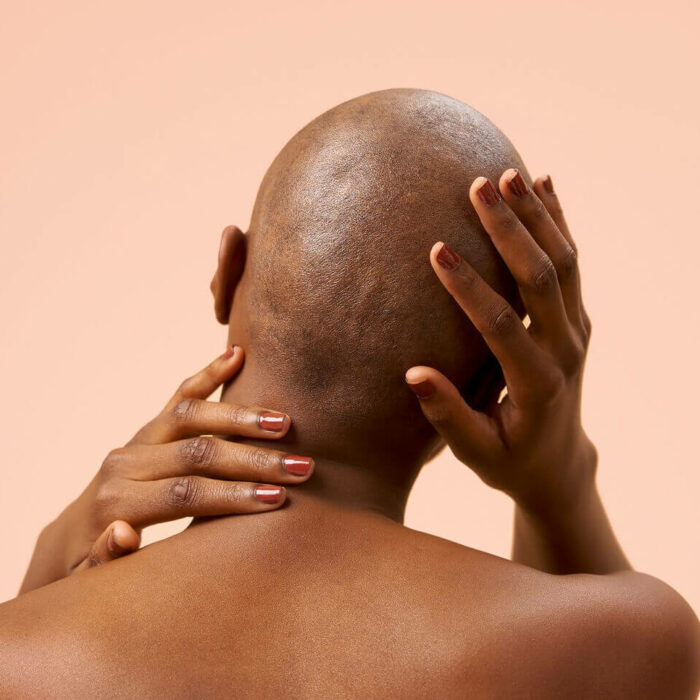 Soulager son cuir chevelu après le port de la perruque