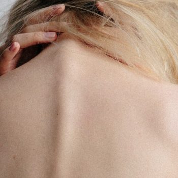 Protégé : Effets psychologiques de la perte des cheveux pendant un cancer