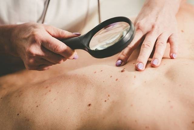 prévenir cancer de la peau