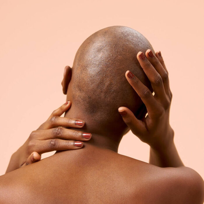 Cancer : préparer la chute de mes cheveux