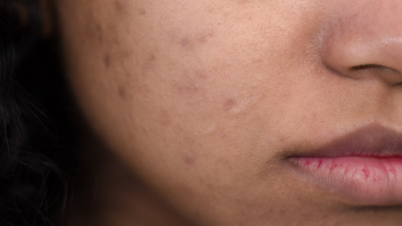 effets-du-soleil-sur-la-peau-protection-solaire-MEME-COSMETICS