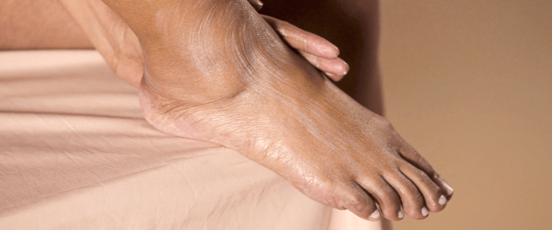 Hand-foot syndrome