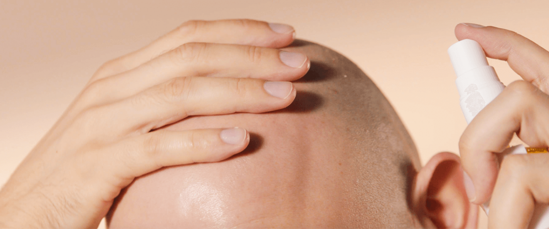 Alopecia, hair regrowth